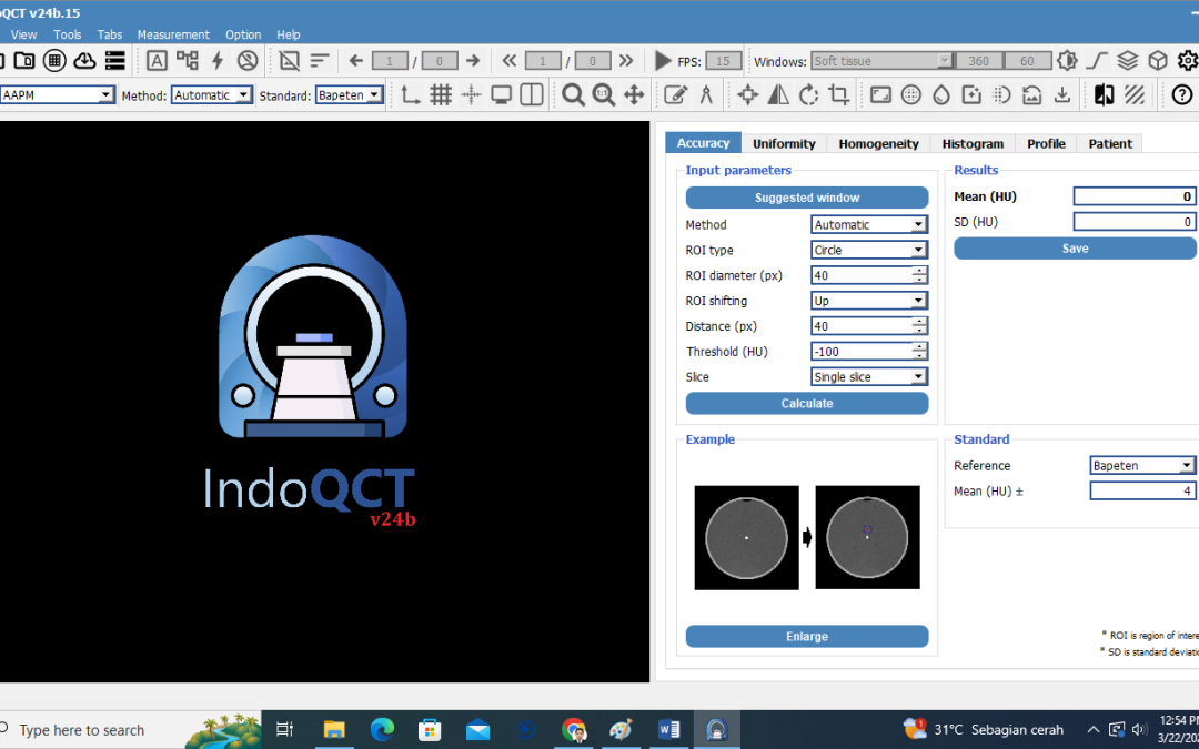 Summer Course in Medical Physics 2025 IndoQCT for CT Image Quality Measurements